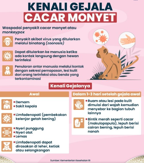 cacar monyet